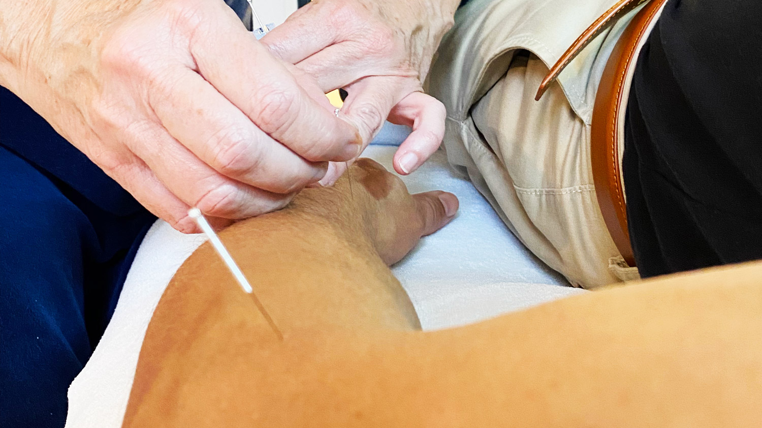 Helhedsorienteret kropsbehandling med akupunktur